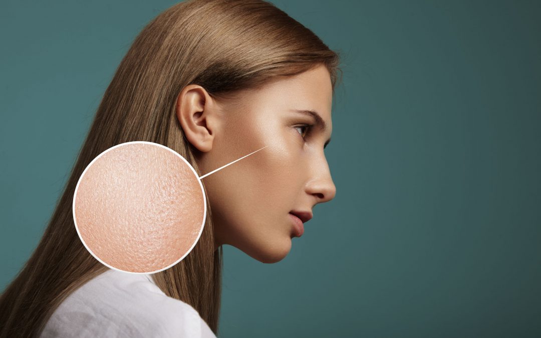 What Causes Large Pores (and how to make them look smaller)