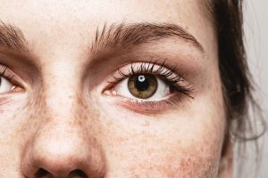 Moles on Scalp | Beverly Hills MD