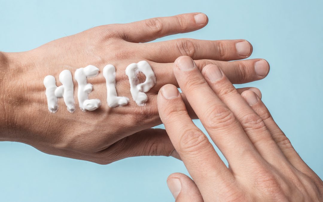 Chapped Hands – You Don’t Have to Live with Them