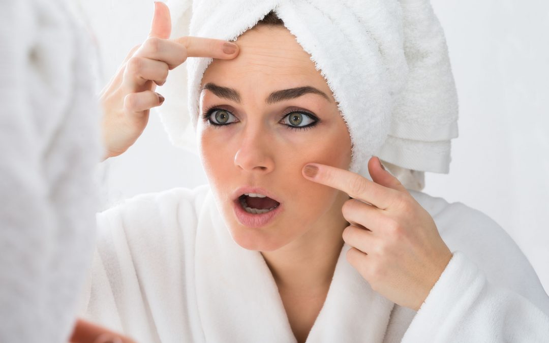 What is Skin Purging and is it Real?