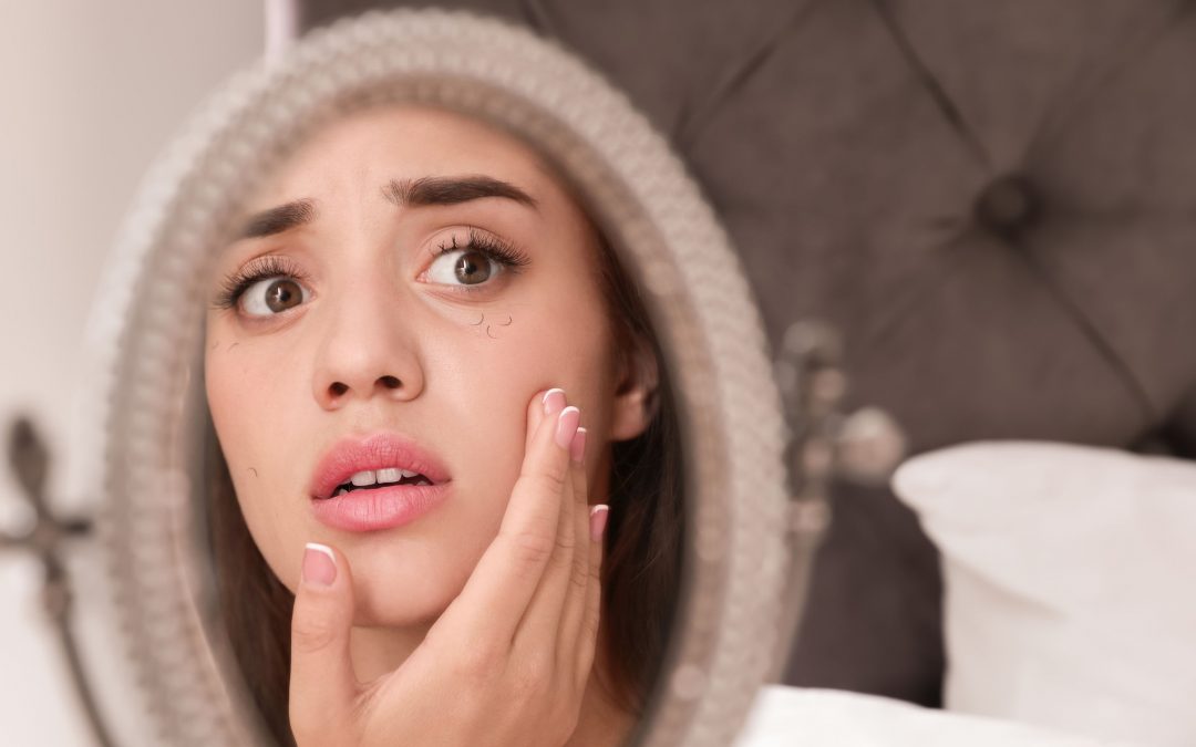 Are You Losing Eyelashes? Check These Bad Habits That Might Be Damaging Your Lashes