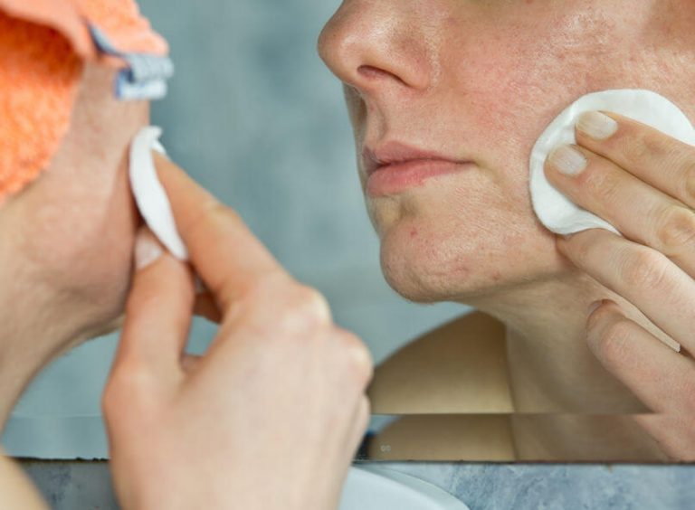 Whiteheads Vs Blackheads What’s The Difference Between These Two Types