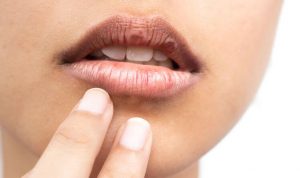 lip exfoliation | Beverly Hills MD