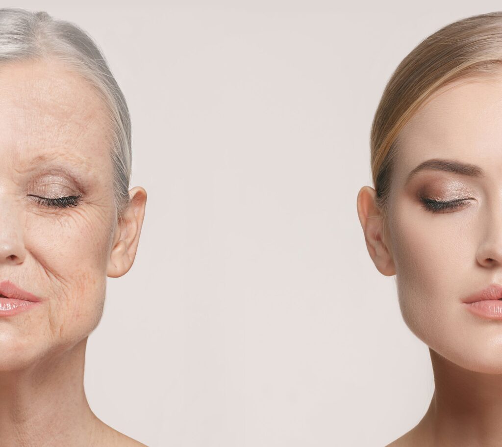 Effects And Signs Of Aging Skin - Beverly Hills MD